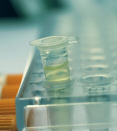 Post thumbnail Understand the Main CMC Challenges to Improve ATMP Development
