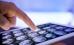Medical Device Software Development: How to build your EU/US strategy?